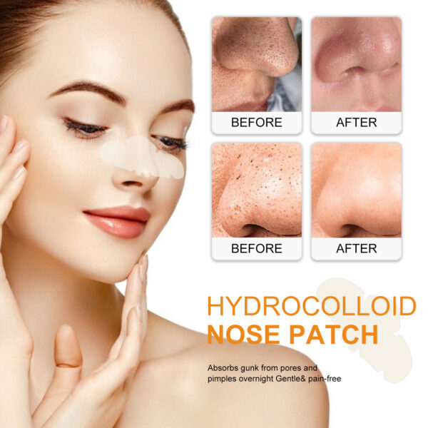 Blackhead Removal Nasal Patch - Image 3